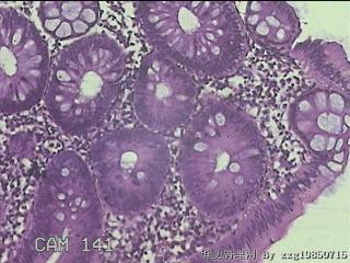 降乙结肠粘膜图2
