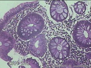 降乙结肠粘膜图5
