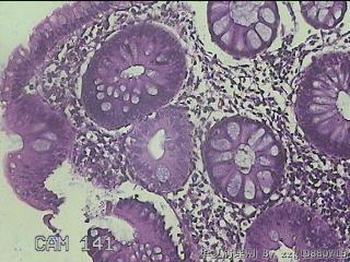 降乙结肠粘膜图9
