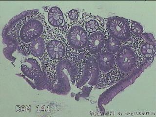 降乙结肠粘膜图8