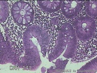 降乙结肠粘膜图7