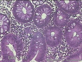 降乙结肠粘膜图4