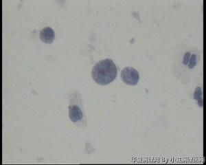 请老师看看48岁TCT，这些裸核细胞怎么报？图2