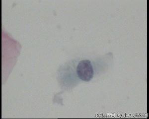 请老师看看48岁TCT，这些裸核细胞怎么报？图12