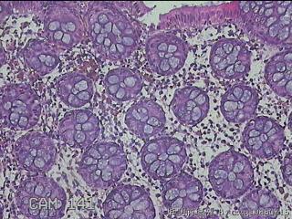 横结肠粘膜图7