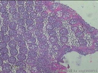 横结肠粘膜图4