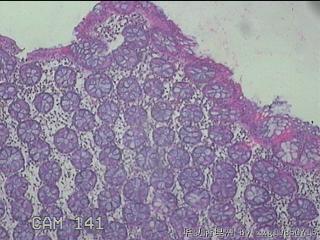 横结肠粘膜图3