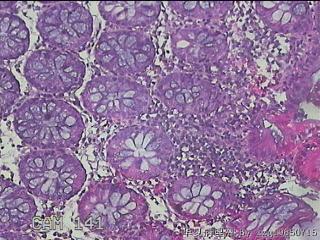 横结肠粘膜图11