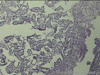 胎盘组织图7