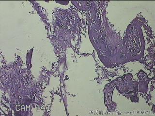 胎盘组织图22