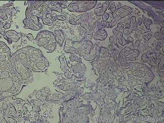 胎盘组织图17