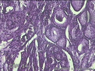 胃体粘膜图6