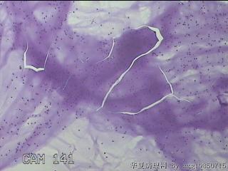 膝关节腔积液5ml图9