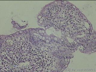 回肠末端粘膜图9
