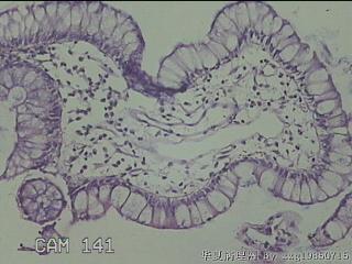 回肠末端粘膜图22