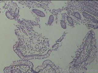 回肠末端粘膜图6