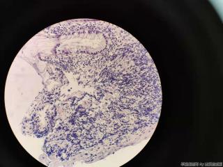 直肠取活检，增生性息肉？图7