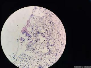 结肠活检，有问题吗？图8