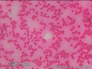 甲状腺细针穿刺涂片图29