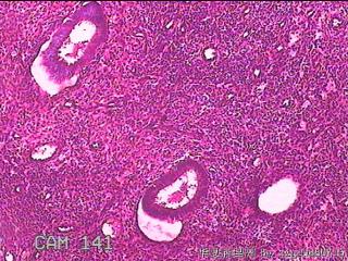 子宫腔内膜组织图31