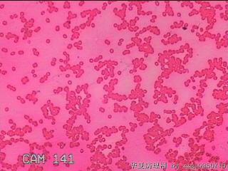 甲状腺细针穿刺涂片图23