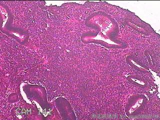 子宫腔内膜组织图21