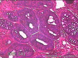 直肠粘膜图8