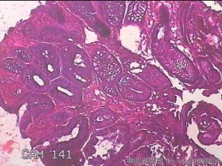 直肠粘膜图4