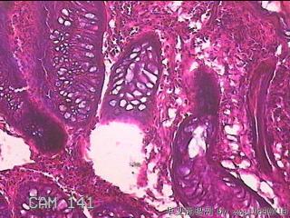 直肠粘膜图9