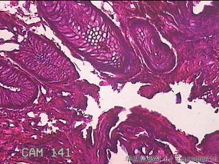 直肠粘膜图13