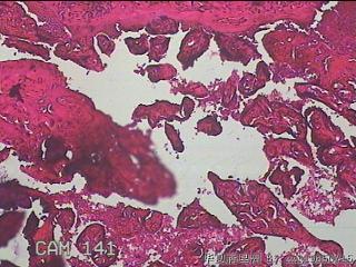 胎盘组织图21