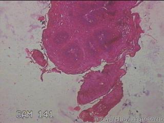 食管中段粘膜图1