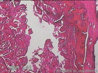 胎盘组织图14