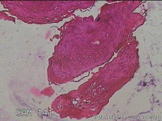 食管中段粘膜图3