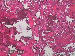 胎盘组织图15