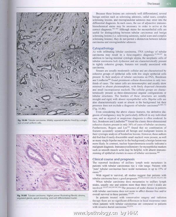 管状癌其他书中的内容图7
