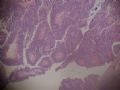卵巢肿瘤，原发部位图1