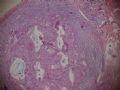 卵巢肿瘤，原发部位图2