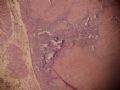 卵巢肿瘤，原发部位图9