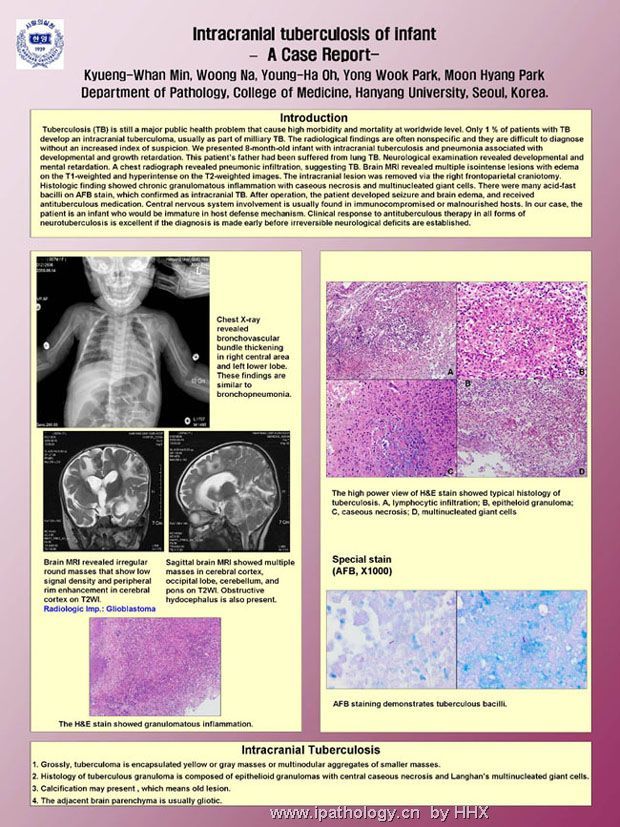 HYUH Poster. Intracranial tuberculosis of infant图1