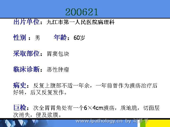 江西省第34届病理学年会(2006年)读片会病例200621图2