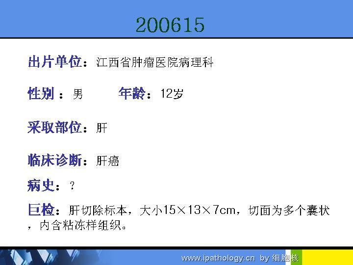 江西省34次病理学术会议读片200615图14