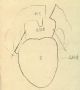 黄受方—全内脏摘出法尸体解剖技术（之五）图1