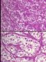涎腺肌上皮瘤的细胞形态图3