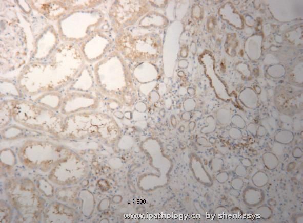 关于肾脏的免疫组化！！请各位帮我分析一下图2