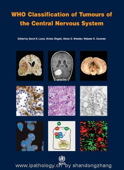 WHO神经系统肿瘤2007年新分类图1