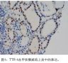 Thyroid Transcription Factor-1(甲状腺核转录因子－1)——转自yang老师文章图1