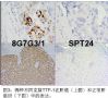 Thyroid Transcription Factor-1(甲状腺核转录因子－1)——转自yang老师文章图3