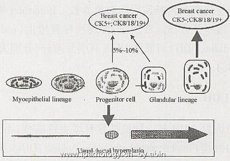 乳腺活检中热点问题的新认识(一)图1