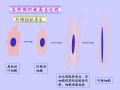 病理学2-第二章 损伤的修复图7